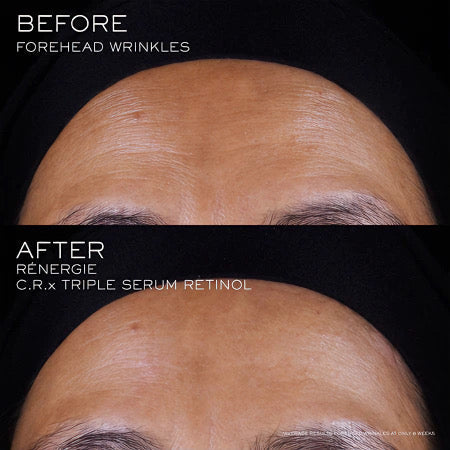 Lancome Renergie Crx Retinol Triple Serum 50ml