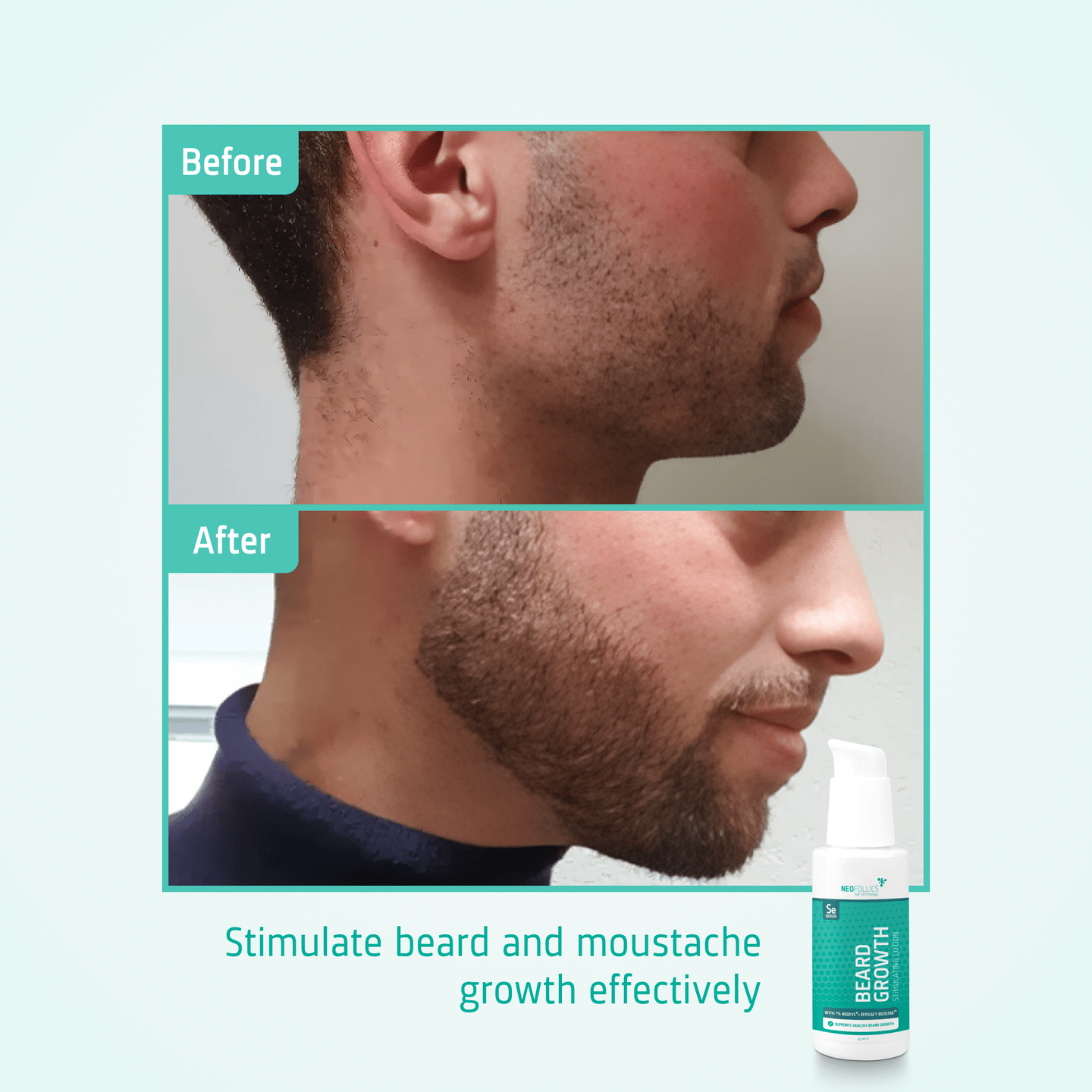 Neofollics Beard Growth Serum For Beard 45ml - Avoriell